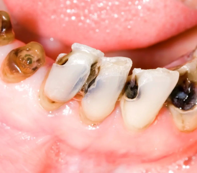Điều trị bệnh lý răng miệng